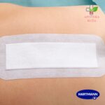 Cosmopor E flaster za rane 15cmx8cm 1 komad