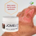 Jomelop G za sveže opekotine 90gr