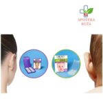 Otostick Baby flasteri za isturene uši za bebe