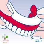 Protefix jastučić za učvršćivanje zubne proteze 30 komada