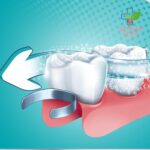 Protefix šumeće tablete za čišćenje proteze 32 komada