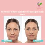 Remescar Instant korektor bora 8ml