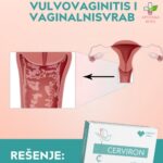 Cerviron protiv vaginalnog peckanja i suvoće vagine 10 ovula