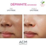 Depiwhite Advanced krema protiv pega i fleka 40ml