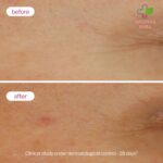 Novexpert Booster serum sa hijaluronskom kiselinom 3,2% 30ml