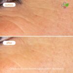 Novexpert Booster serum sa vitaminom C 30ml