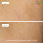 Novexpert Ciljani korektor tamnih mrlja 2ml