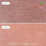 Novexpert Clear Skin pena za umivanje 150ml