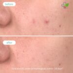 Novexpert Clear Skin piling AHA i PHA 30ml