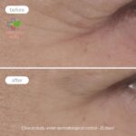 Novexpert Expert Anti Aging krema za zonu oko očiju 15ml