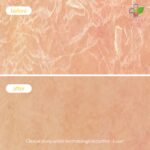 Novexpert Obnavljajuća ekstra bogata krema za normalnu, suvu i veoma suvu kožu 40ml