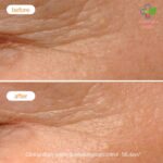 Novexpert Piling noćna krema za normalnu, kombinovanu i masnu kožu 40ml