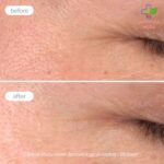 Novexpert Pro-Collagen Booster Serum za sve tipove kože 30ml