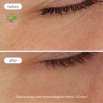 Novexpert Pro-Retinol dual booster serum za sve tipove kože, sem masne 30ml