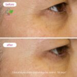 Novexpert Repulp Krema za mešovitu i masnu kožu 40ml