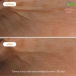 Novexpert Vitamin C radiance piling za normalnu i masnu kožu 30ml