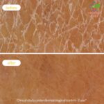 Novexpert Zaštitna bogata krema za normalnu i suvu kožu 40ml