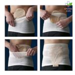 Stomasafe Classic Light pojas za fiksiranje kese oko stome veličina S