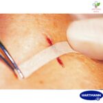 Omnistrip flasteri za zatvaranje rana 12mm x 101mm 1 komad