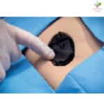 Acticoat Flex 3 antimikrobna obloga za rane 10cm x 10cm 1 komad