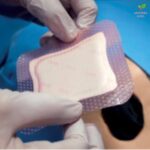 Acticoat Flex 3 antimikrobna obloga za rane 10cm x 10cm 1 komad