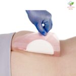 Allevyn Life (najdeblja petoslojna obloga) za rane 17,2cm x 17,5cm 1 komad