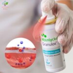 Granulox hemoglobinski sprej za rane 12ml
