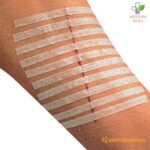 Leukostrip flasteri za zatvaranje rane 38mm x 4mm 1 komad