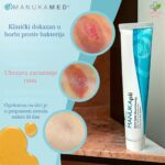 Manukapli antibakterijski manuka med za rane 44gr