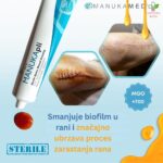 Manukapli antibakterijski manuka med za rane 44gr