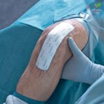 Mepilex Border Post Op 10cm x 20cm obloga za rane 1 komad