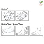 Mepilex Talon za dekubitus na peti 13cm x 21cm 1 komad