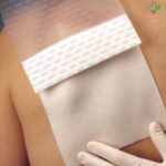 Mepilex Transfer obloga za rane 20cm x 50cm 1 komad