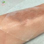 Mepitel One obloga za opekotine 17cm x 25cm 1 komad