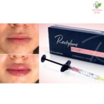 Restylane Kysse filer za usne 1ml